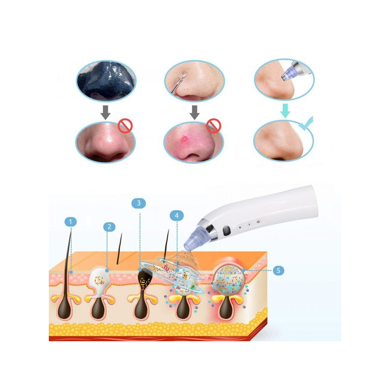 Вакуум уред за почистване на лице и черни точки