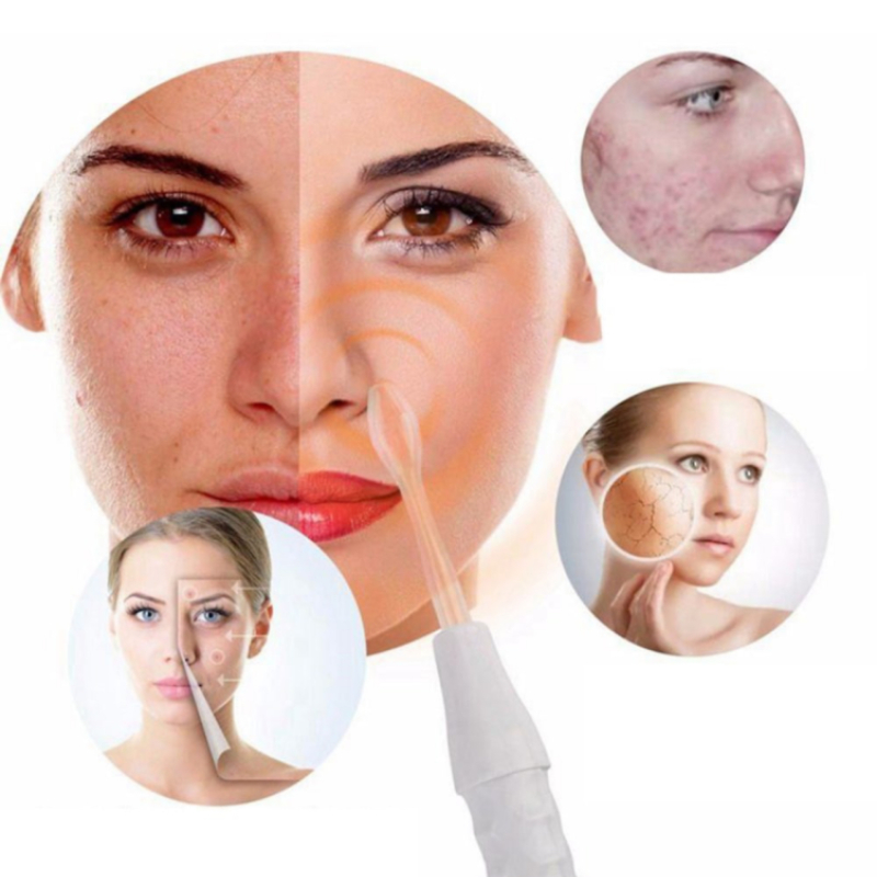 Дарсонвал за лице